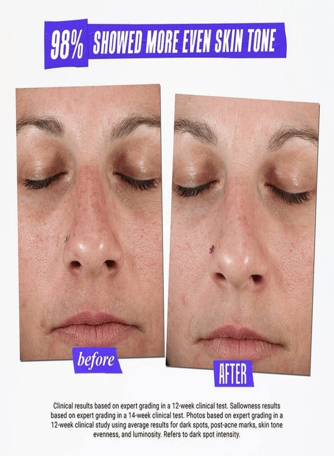 Kiehl's Kiehl’s Clearly Corrective™ Dark Spot Solution 50ml | Brightening Serum for Dark Spots & Uneven Tone  - Image 3