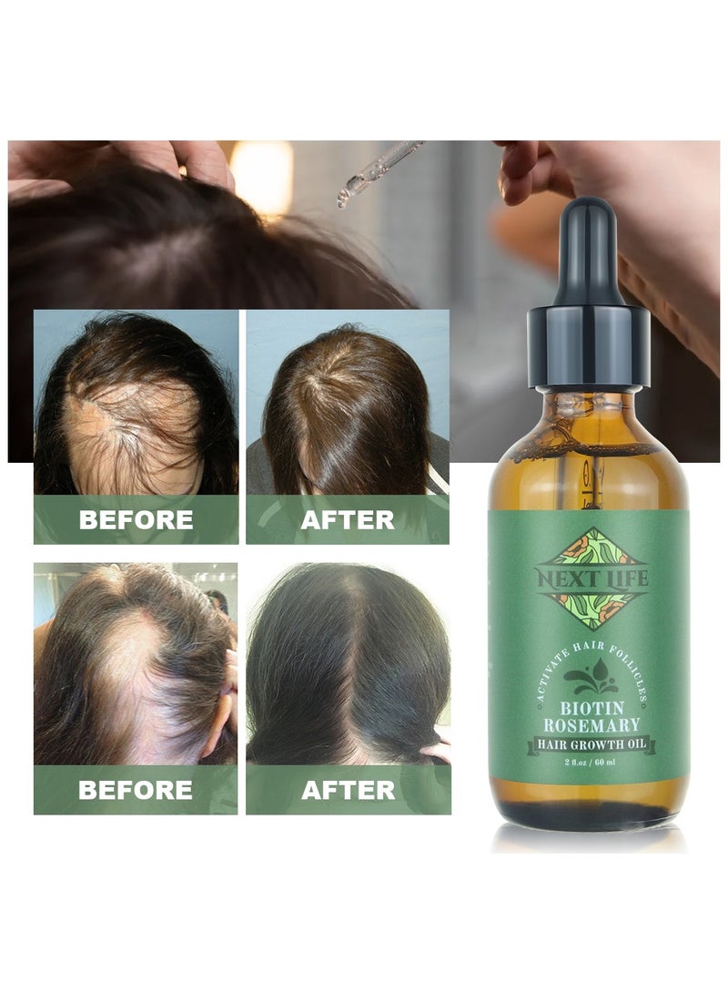 Next Life Rosemary Essential And Hair Strengthening Oil for Hair Growth and Thinning Hair & Anti Hair fall Oil for All Hair Types - Image 5
