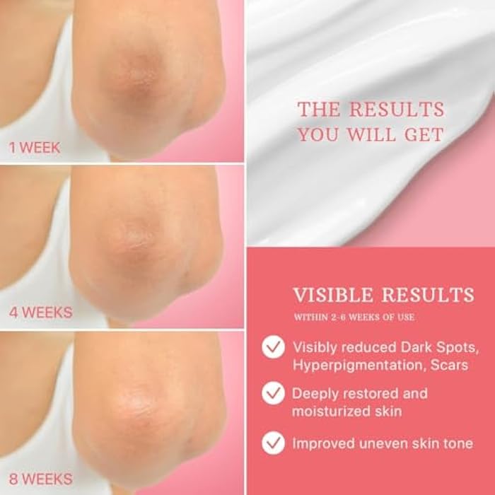 ESSENLIS Dark Spot Remover for Face, Body, Underarms, Armpit, Knees, Elbows, Sensitive Area, Promotes Anti-Aging Effect, Dark Spot Corrector for Women and Men (1,7 Fl Oz) - Image 5
