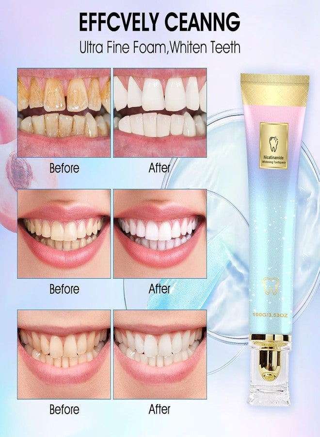 weispo 2PCS Niacinamide Whitening Toothpaste,Niacinamid Toothpast,Niacinamide Intensive Whitening Toothpaste, Fresh Breath, Remove Tooth Stains,Complete Care - Image 4