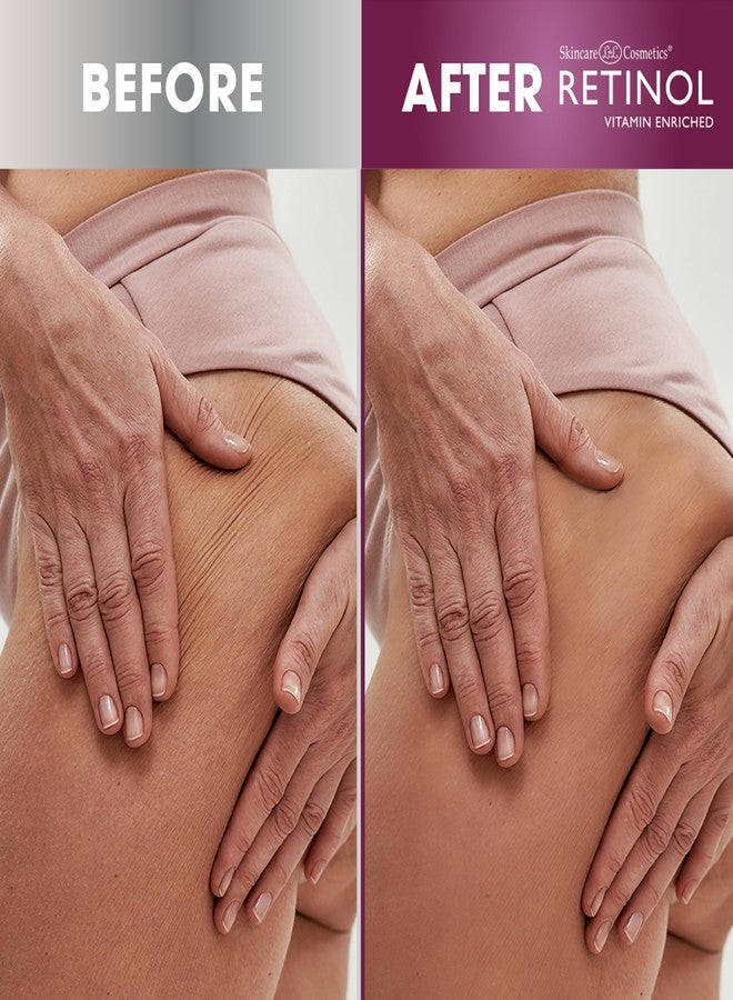 RETINOL كريم ريتينول المضاد للشيخوخة - يشد، ينعم، ويستعيد مرونة البشرة للحصول على إشراقة شبابية 4 أونصات - Image 4