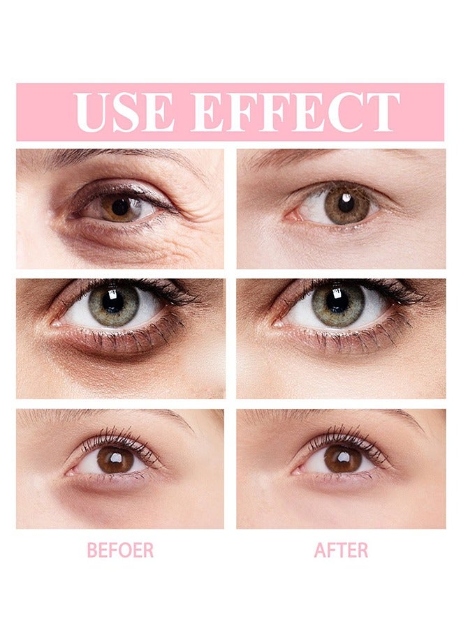EELHOE Retinol Eye Cream Stick 3g，For Dark Circles and Puffiness,Dark Circle Fine Lines Treatment, Under Eye Serum Balm Skin Care - Image 3