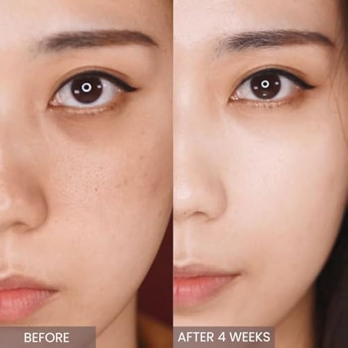 aplin RETINOL 0.1 CREAM/Skin Moisturizer/Facial Moisturizers Official/Korean Cosmetics/Korean Skin Care/RETINOL - Image 4