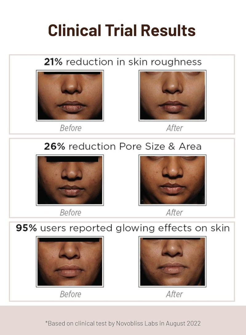 SkinQ Niacinamide and Vitamin C Face Mask AHA Based for Glowing Skin Reduces Tan Fights Pigmentation Instant Glow in 15 Minutes for All Skin Types Women and Men 60g - Image 3
