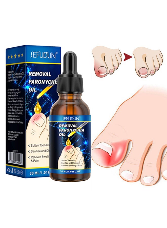 Sefudun Removal Paronychia Oil,Toenail care Ingrown Toenail Nail Repair Toenail Plus Anti Paronychia Relief Oil Nail Renewal Liquid for Damaged and Discoloration Nail Swelling and Pain removal Oil 30ml  - Image 1