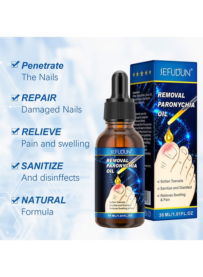 Sefudun Removal Paronychia Oil,Toenail care Ingrown Toenail Nail Repair Toenail Plus Anti Paronychia Relief Oil Nail Renewal Liquid for Damaged and Discoloration Nail Swelling and Pain removal Oil 30ml  - Image 2