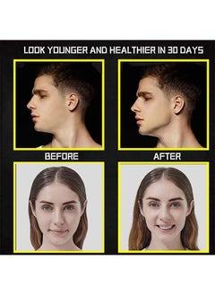 Generic 4 Pcs Jawline Exerciser  - Image 3