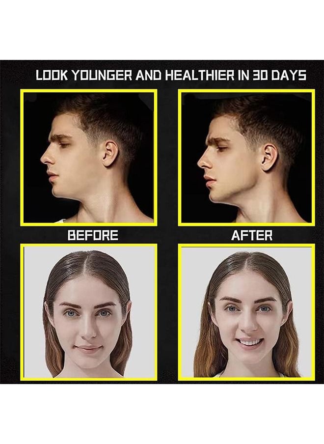 Generic 4 Pcs Jawline Exerciser  - Image 3