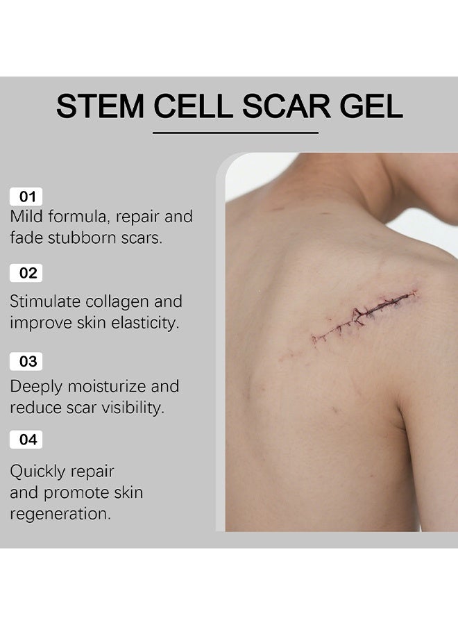 Feimuko Regenscar Stem Cell Scar Gel, Advanced Scar Gel, Scar Removal Gel, Treats Old And New Scars, Reduces The Appearance Of Scars From Acne, Stitches, Burns And More, 20g - Image 5