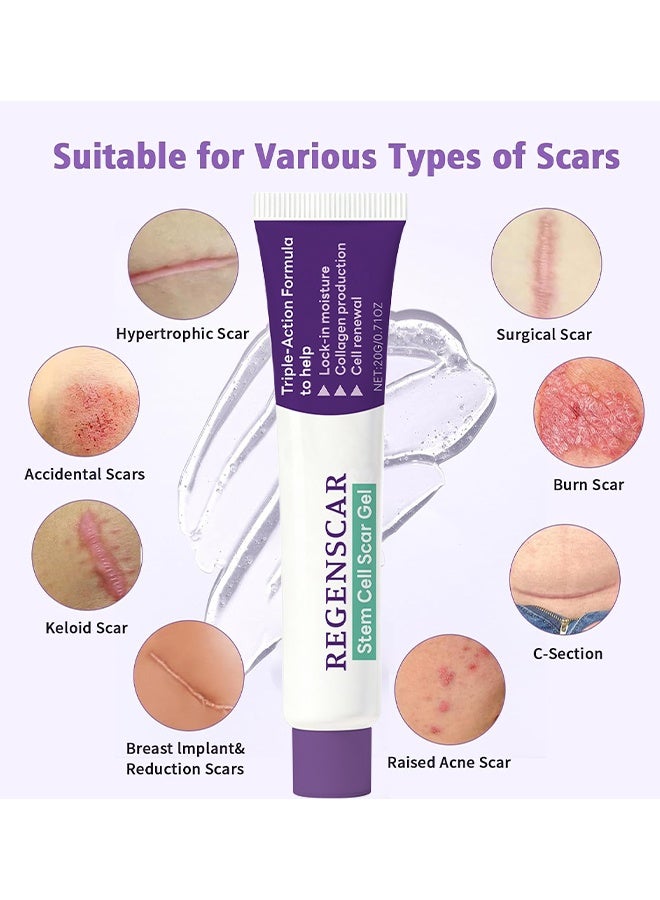 Feimuko Regenscar Stem Cell Scar Gel, Advanced Scar Gel, Scar Removal Gel, Treats Old And New Scars, Reduces The Appearance Of Scars From Acne, Stitches, Burns And More, 20g - Image 3