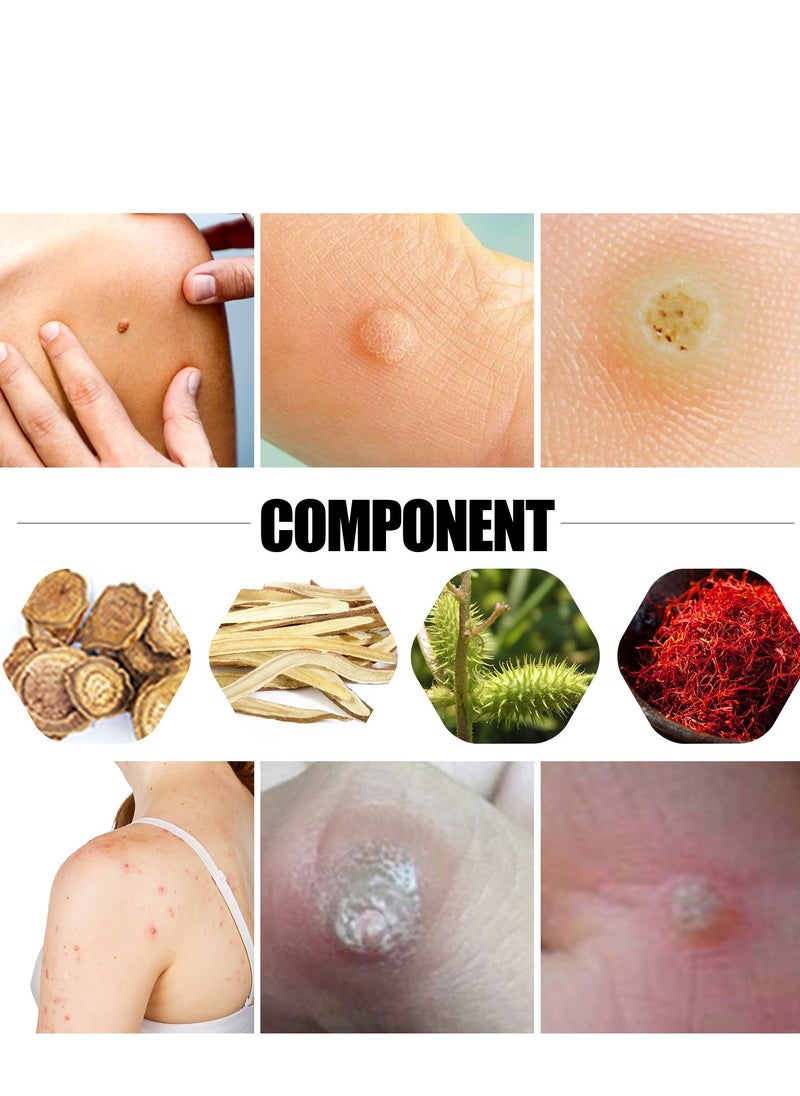 Generic Self-Adhesive Corn Removers for Feet, 12PCS Corn Remover Breathable Callus Cushions Plants Composed Corn Pads Foot Care Callus Feet Remover Patch  - Image 4