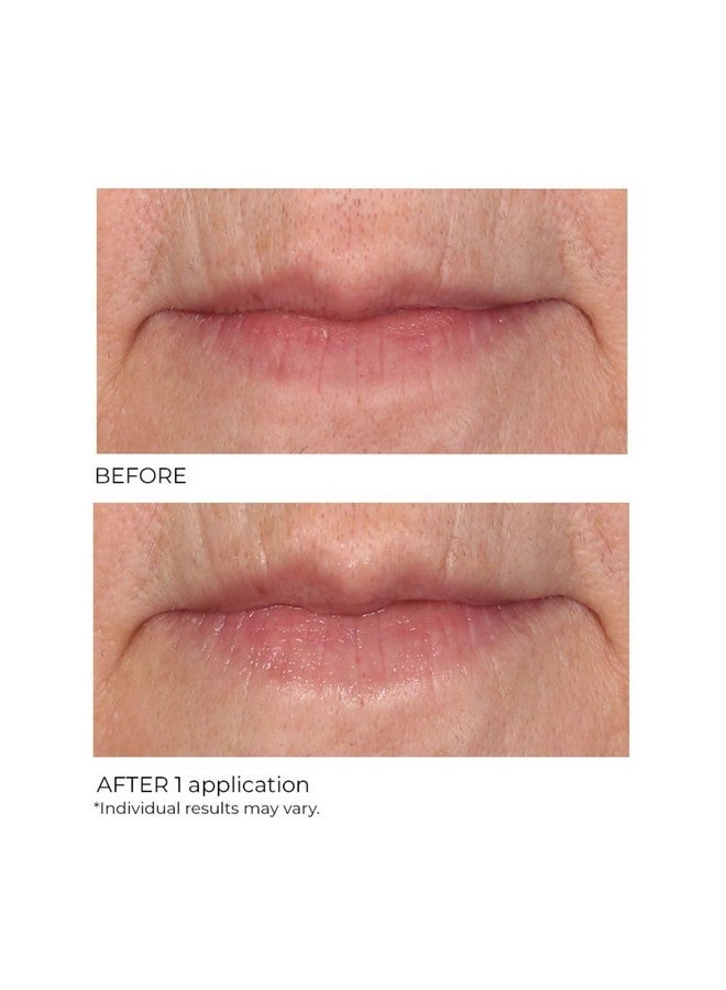 nassif md Nassifmd Lip Sugar Scrub Pink Champagne - Image 4