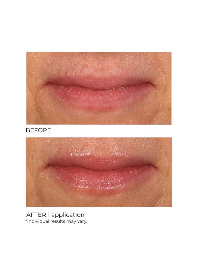 nassif md Nassifmd Lip Sugar Scrub Pink Champagne - Image 5