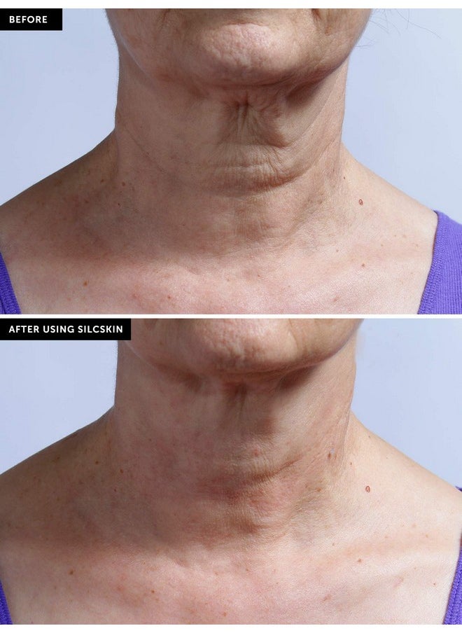 Silc Skin - Collette Pad To Help With Neck & Collarbone Wrinkles From Sun Aging Side Sleeping Reusable Self Adhesive Medical Grade Silicone 30 Day Supply - Image 1