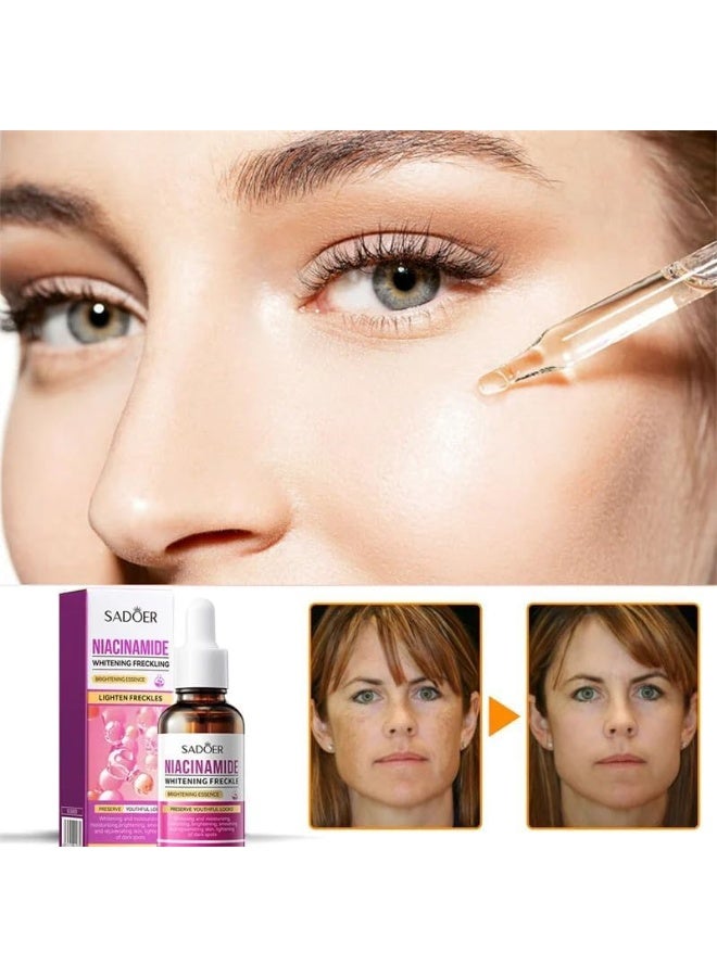 SADOER niacinamide whiten anti-freckle brightening essence lighten freckles 30ml - Image 5