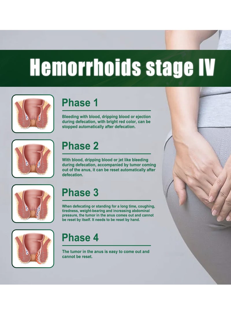 Hemorrhoid Cream for Relieve Perianal Itching and Treat Hemorrhoids
