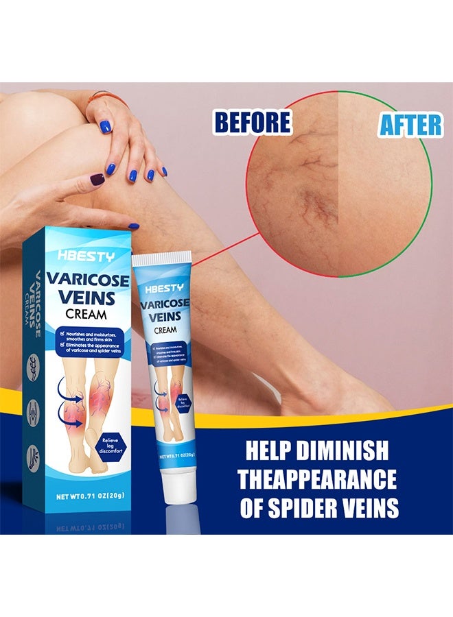 HBESTY Varicose Veins Cream Relief Phlebitis Angiitis 100% Natural Ingredients Added Eliminate the Appearance of Varicose Veins - Vein Inflammation Treatment for Men & Women 20g - Image 4