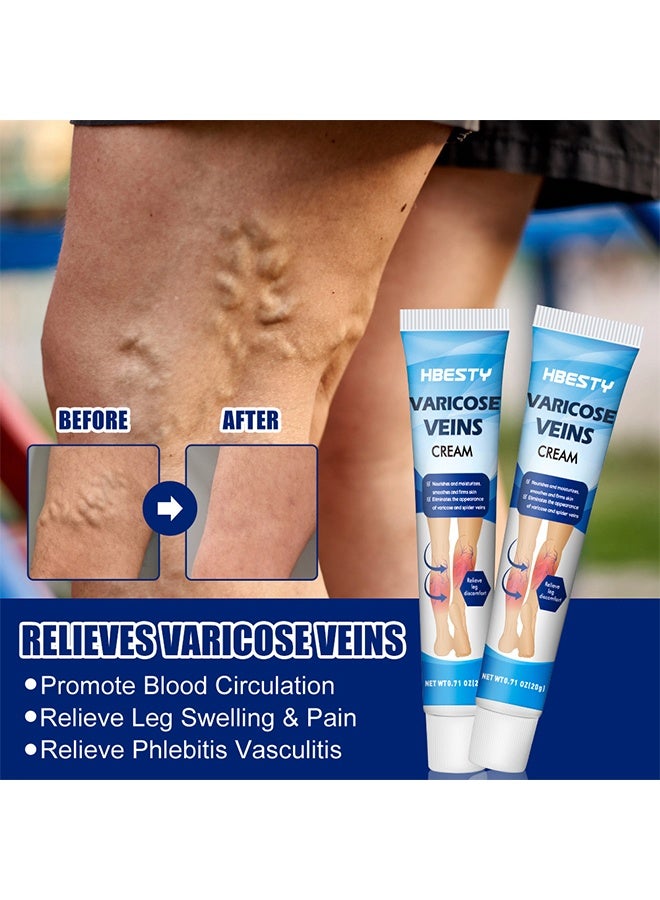 HBESTY Varicose Veins Cream Relief Phlebitis Angiitis 100% Natural Ingredients Added Eliminate the Appearance of Varicose Veins - Vein Inflammation Treatment for Men & Women 20g - Image 3