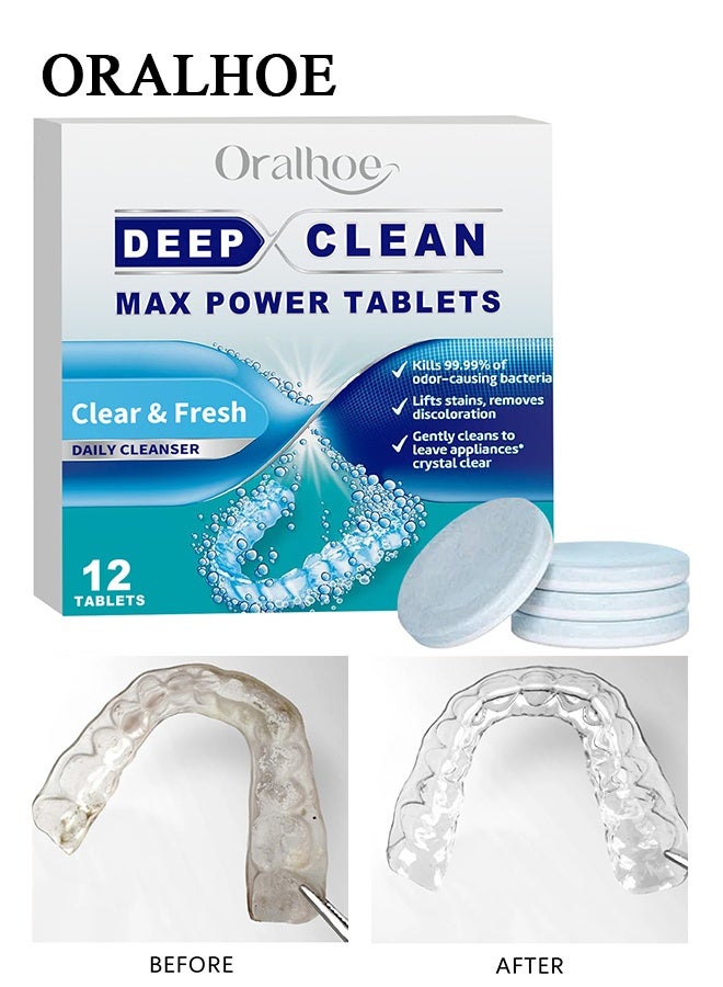 ORALHOE Retainer Cleaner Tablets - 12 Denture Cleaning Tablets & Aligner Cleaner - Removes Odors & Stains - For Aligners, Retainers, Dentures, Night Guards - Mint Flavor - Image 1