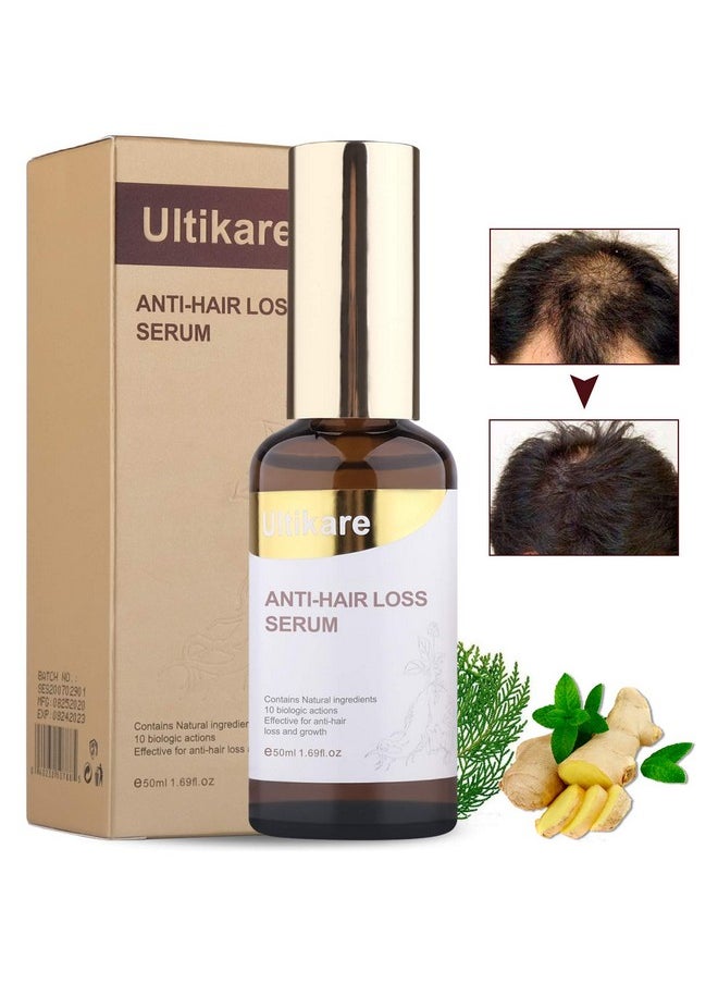 Ultikare Ltikare Ginger Germinal Oil Ginger Hair Growth Oil Hair Growth Serum Hair Care Serum Stop Hair Loss Liquid For Women And Men Hair Growth Ginger Essential Oil To Help Grow Ginger Oil For Hair Growth  - Image 1