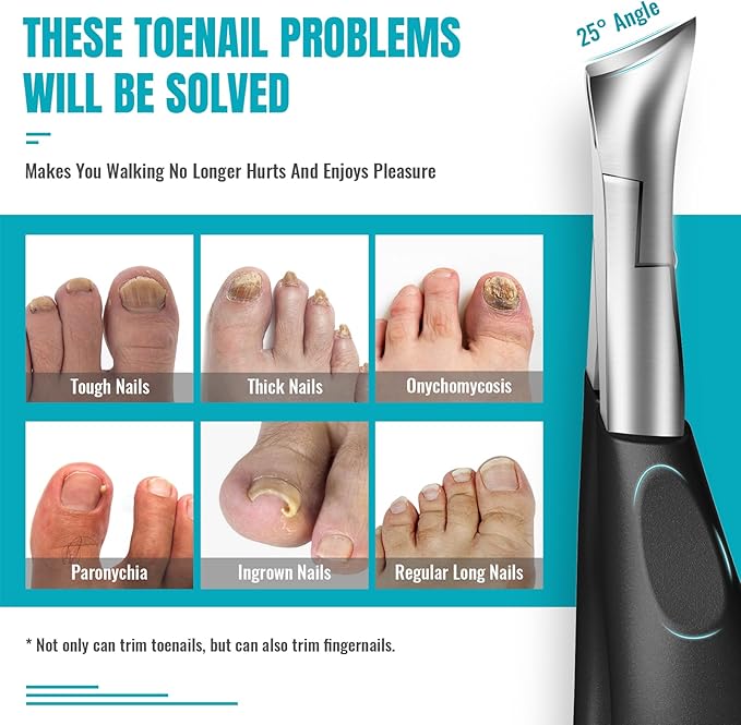 RONAVO Podiatrist Toenail Clippers Professional Thick Ingrown Toe Nail Clippers for Men Seniors Pedicure Clippers Toenail Cutters Super Sharp Curved Blade Grooming Tool - Image 3