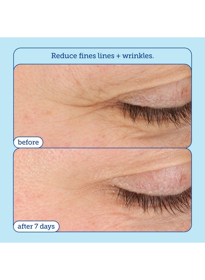 Skinfix Skinfix Barrier+ Triple Lipid-Boost 360° Eye Cream: Targets Dark Circles, Puffiness, and Fine Lines Around Eyes and Lids, Clinically Proven to Brighten and Refresh Eyes, 0.5 oz  - Image 2