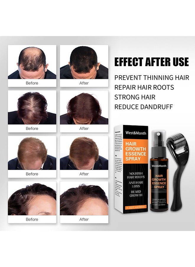 West&Month Hair Growth Essence Spray - Anti-Slip Hair Nourishing Growth Liquid Thickening Hairline Essence Spray With Microne Roller 30ml  - Image 5