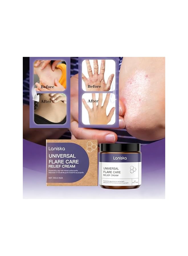 LANISKA Universal Flare Relief Cream – Soothing Drawing Salve for Skin Irritation, Redness Itching, Anti-Chafing Balm for Sensitive Areas, Enriched with Propolis Egg Yolk Extract (50g) - Image 5