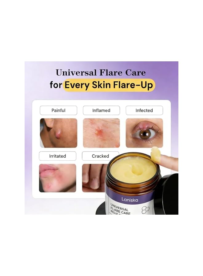 LANISKA Universal Flare Relief Cream – Soothing Drawing Salve for Skin Irritation, Redness Itching, Anti-Chafing Balm for Sensitive Areas, Enriched with Propolis Egg Yolk Extract (50g) - Image 2