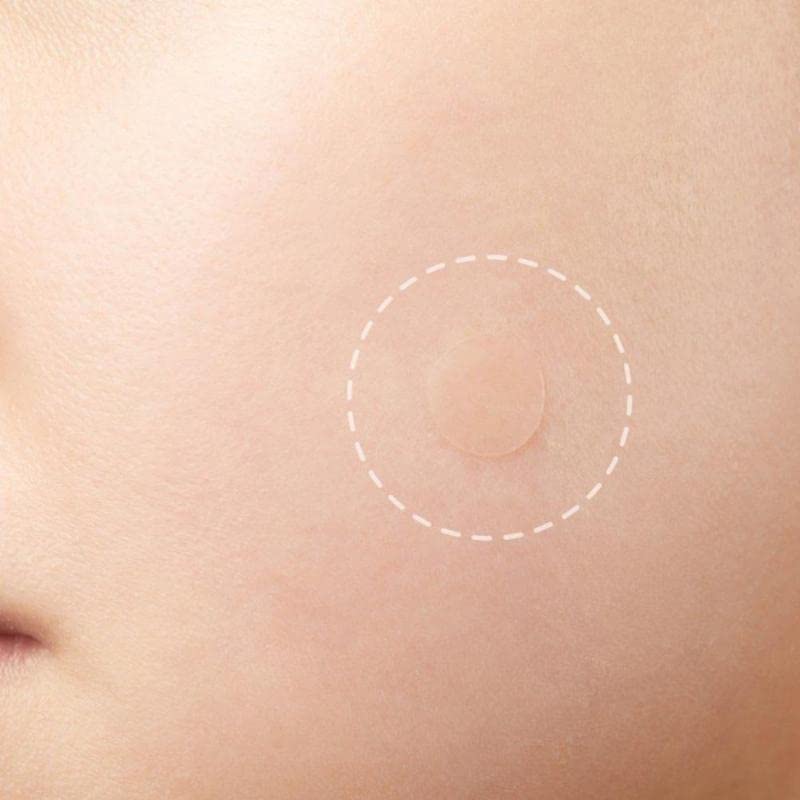 Mluffy 36Pcs Face Spot Scar Care Sticker Invisible Absorbing Spot Dot Waterproof Pimple Patch Sheet for Girls Skin Care Transparent Pack Of 1 - Image 5