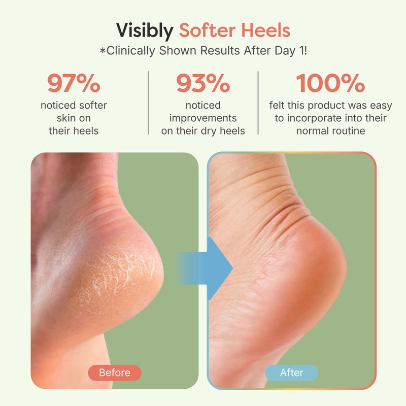 ZenToes Moisturizing Socks for Cracked Heel Treatment, Vitamin E, Olive Oil and Jojoba Oil Infused Heel Socks, Spa Gifts for Women, Relaxation Gifts for Women (Fuzzy Mint Green, Regular) - Image 3
