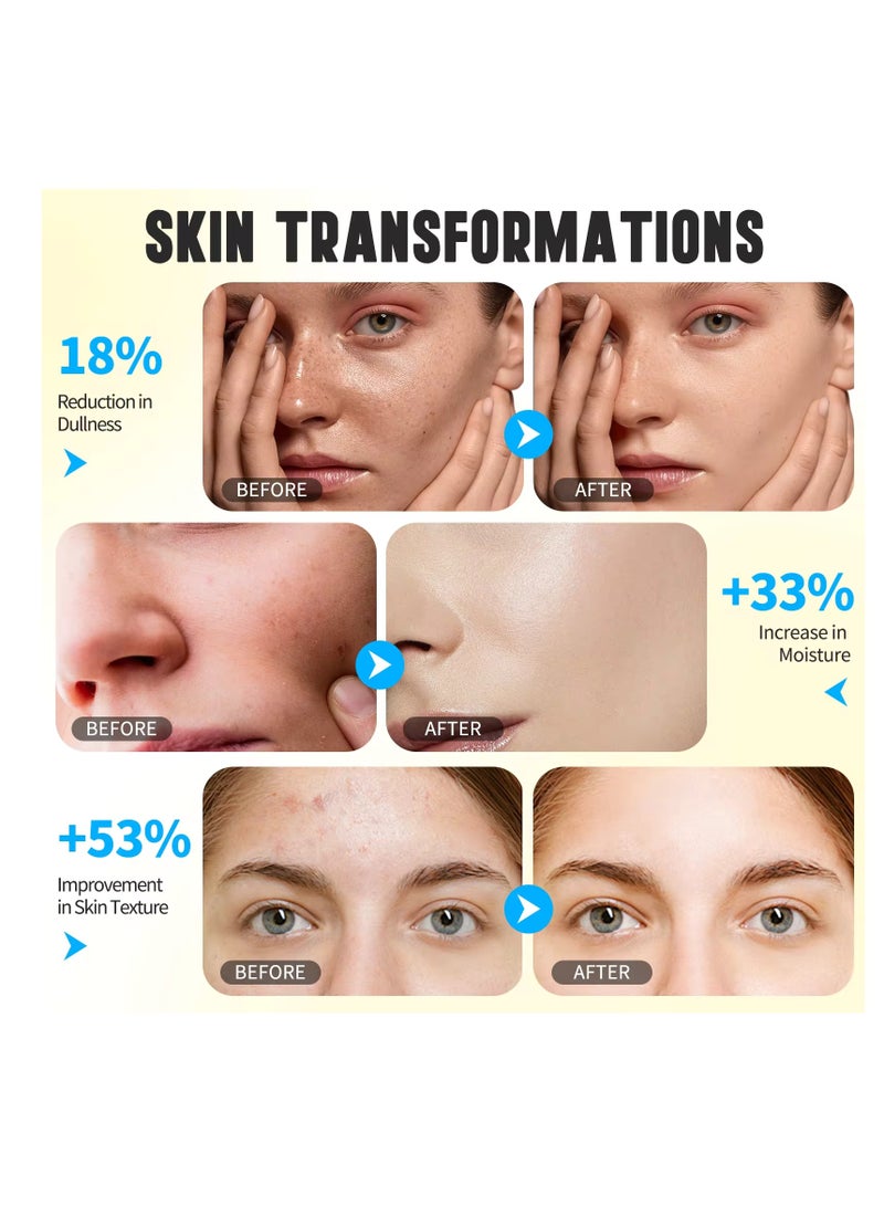 ALIVER 150 مل من موس التنظيف بحمض الكوجيك والكركم رغوة التنظيف بحمض الكوجيك والكركم تقلل من البقع الداكنة تساعد على توازن زيت البشرة والماء تتلاشى البقع تزيل الكيراتين الزائد تنظف الزيت تنقي المسام - Image 5