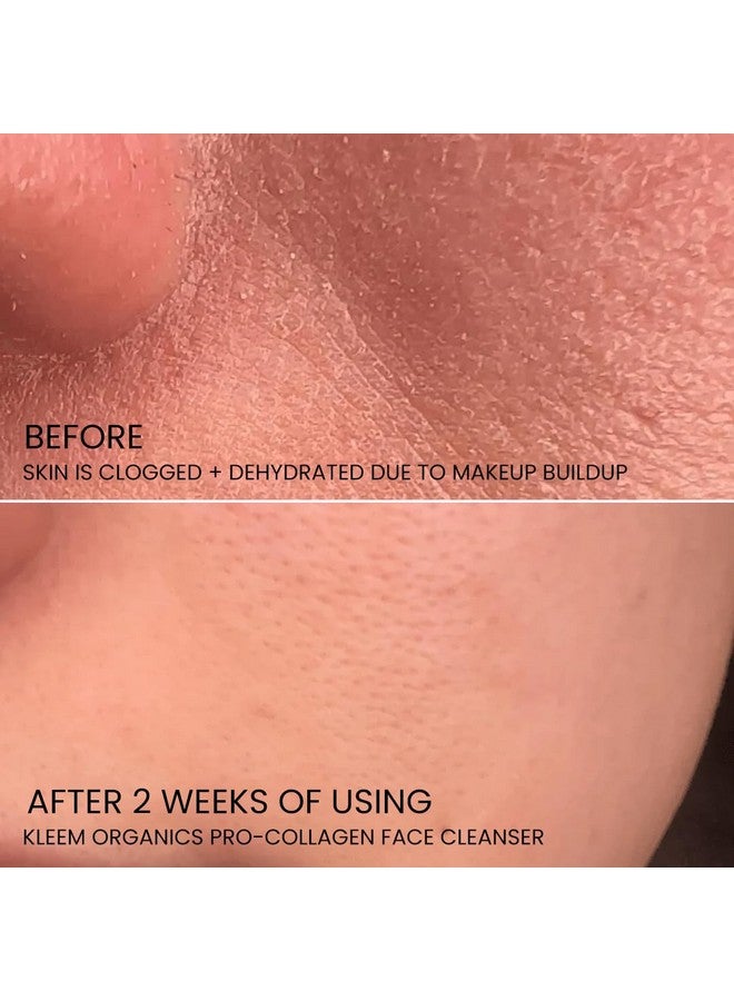 Kleem Organics Leem Organics Procollagen Glycolic Acid Face Wash With Salicylic Acid Organic Face Cleanser For Women & Men To Unclog Pores & Improve Skin Tone And Texture Gentle Exfoliating Face Wash 4.05 Oz - Image 3