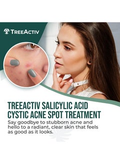 TreeActiv Cystic Acne Spot Treatment Salicylic Acid Acne Treatment For Face Acne Spot Cream Hormonal Acne Treatment Acne Spot Treatment For Face And Body Acne Cream For Teens & Adults 0.5 Fl Oz  - Image 2