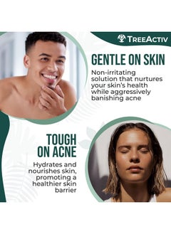 TreeActiv Cystic Acne Spot Treatment Salicylic Acid Acne Treatment For Face Acne Spot Cream Hormonal Acne Treatment Acne Spot Treatment For Face And Body Acne Cream For Teens & Adults 0.5 Fl Oz  - Image 4