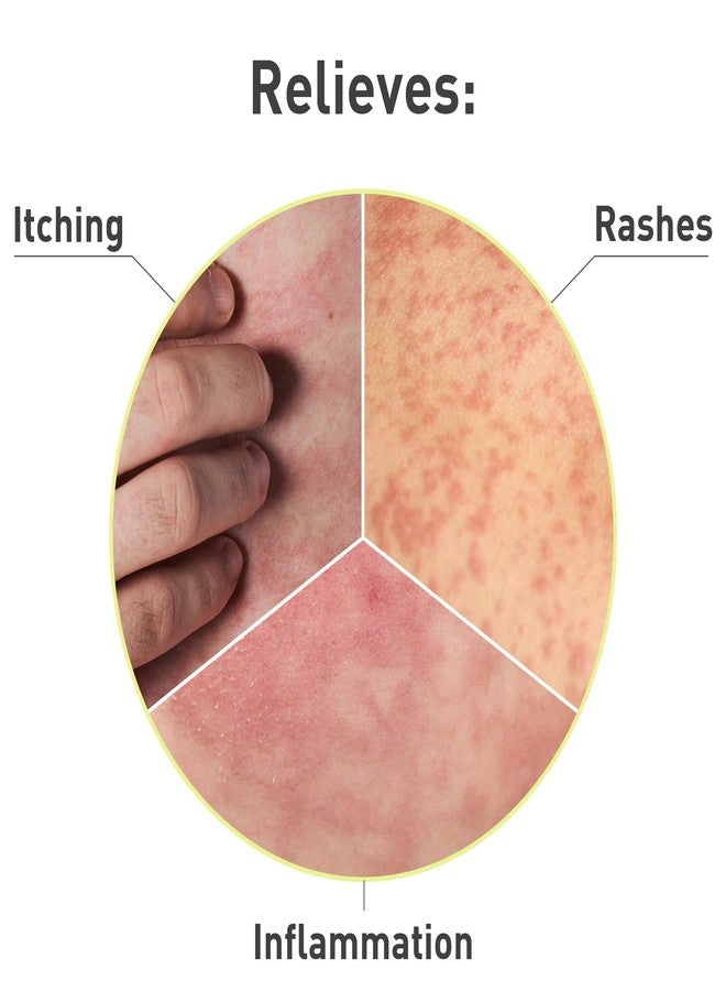 السلطة شراء كريم هيدروكورتيزون - Image 3