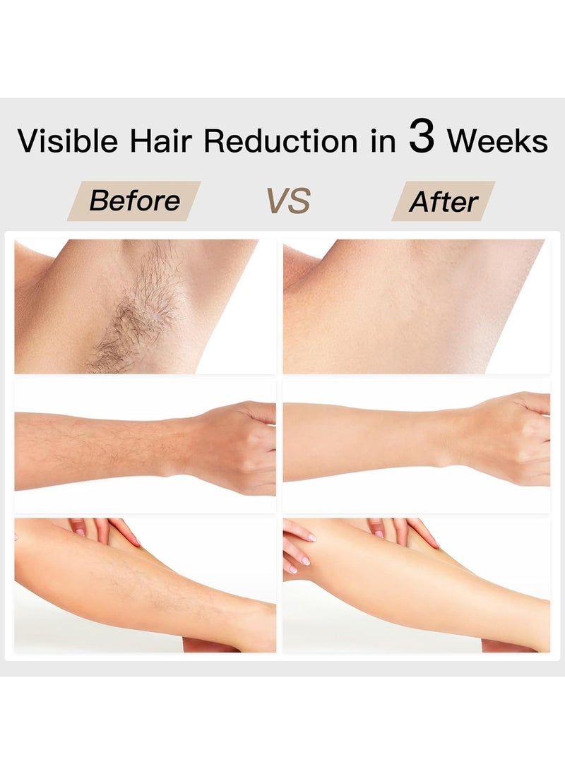 Professional IPL Laser Hair Removal Machine Green for Permanent Whole Body Hair Removal Men and Women