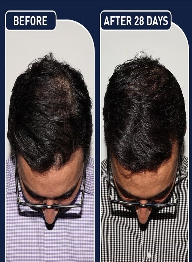 FEG Hair Growth Spray 50ml - Image 5