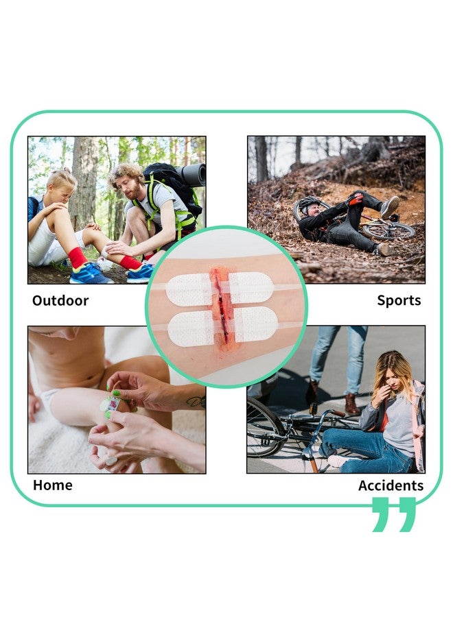 رينو ريسكيو مجموعة إغلاق الجروح من RHINO RESCUE، 6 قطع مع ضمادات، شرائط إغلاق الجروح بدون خياطة، مجموعة إغلاق الجروح بسحاب غرز للعناية بالجروح، ضمادات لاصقة لإغلاق الجروح، مؤهلة للحصول على حساب الادخار الصحي/حساب الادخار المرن - Image 4