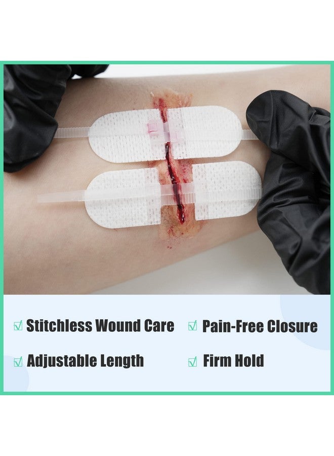 رينو ريسكيو مجموعة إغلاق الجروح من RHINO RESCUE، 6 قطع مع ضمادات، شرائط إغلاق الجروح بدون خياطة، مجموعة إغلاق الجروح بسحاب غرز للعناية بالجروح، ضمادات لاصقة لإغلاق الجروح، مؤهلة للحصول على حساب الادخار الصحي/حساب الادخار المرن - Image 2