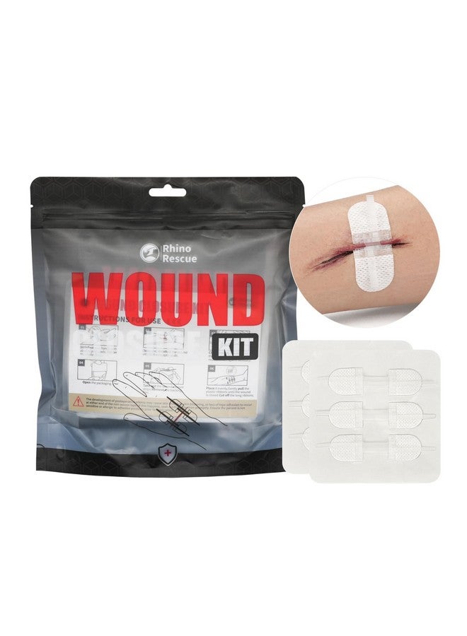 رينو ريسكيو مجموعة إغلاق الجروح من RHINO RESCUE، 6 قطع مع ضمادات، شرائط إغلاق الجروح بدون خياطة، مجموعة إغلاق الجروح بسحاب غرز للعناية بالجروح، ضمادات لاصقة لإغلاق الجروح، مؤهلة للحصول على حساب الادخار الصحي/حساب الادخار المرن - Image 1