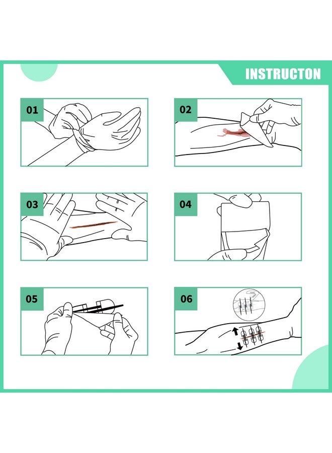 رينو ريسكيو مجموعة إغلاق الجروح من RHINO RESCUE، 6 قطع مع ضمادات، شرائط إغلاق الجروح بدون خياطة، مجموعة إغلاق الجروح بسحاب غرز للعناية بالجروح، ضمادات لاصقة لإغلاق الجروح، مؤهلة للحصول على حساب الادخار الصحي/حساب الادخار المرن - Image 5