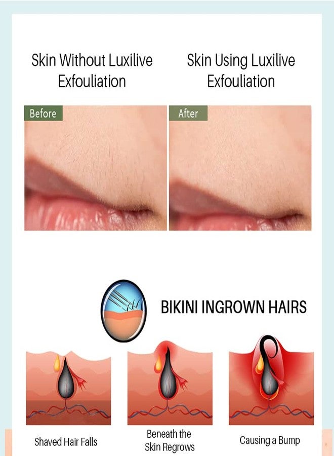 PANSLY Ingrown Hair Repair Rollerball - Improve Shaving Redness & Dullness Chicken Skin Strawberry Legs for Bikini Area Underarms Silky Clear with Salicylic Acid (Pack of 1) - Image 3