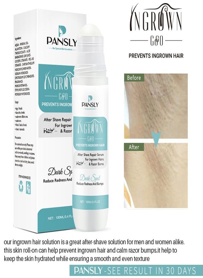 PANSLY Ingrown Hair Repair Rollerball - Improve Shaving Redness & Dullness Chicken Skin Strawberry Legs for Bikini Area Underarms Silky Clear with Salicylic Acid (Pack of 1) - Image 2