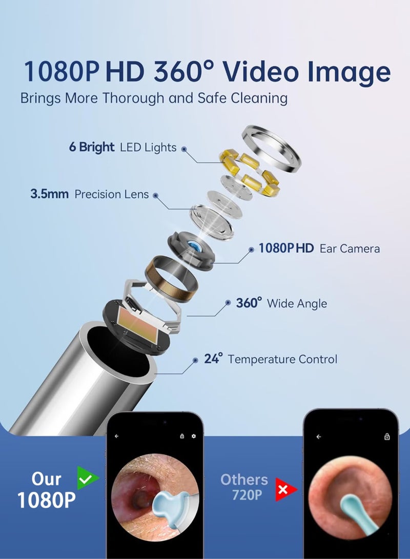 لوبوفان إزالة شمع الأذن - 2000W HD Camera مع أداة مزيل شمع الأذن الكاميرا مع 9 PCS مجموعة أذن - مجموعة أذن شمع الأذن مع ضوء 6 ملاعق أذن ناعمة - منظف الأذن لـ iOS & Android - Image 2