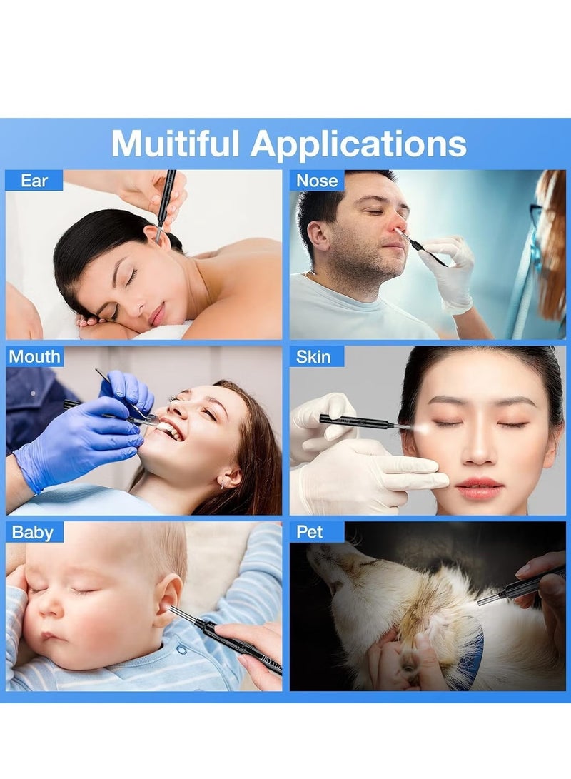 لوبوفان إزالة شمع الأذن - 2000W HD Camera مع أداة مزيل شمع الأذن الكاميرا مع 9 PCS مجموعة أذن - مجموعة أذن شمع الأذن مع ضوء 6 ملاعق أذن ناعمة - منظف الأذن لـ iOS & Android - Image 3