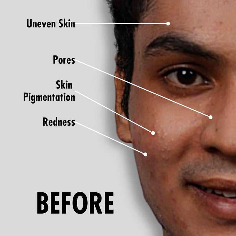 YAAN MAN Ultimate Set Base Foundation Set Spray Tinted Moisturiser Face Wash Gel Moisturiser Perfection Stick Skin Care Make Up For Men For All Skin Types Medium 6 Count - Image 4