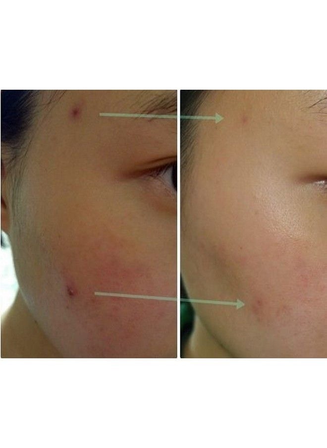 Sidmool - Spot Cream For Skin Barrier Care Rapid Cooling Darkish Blemish - Image 1