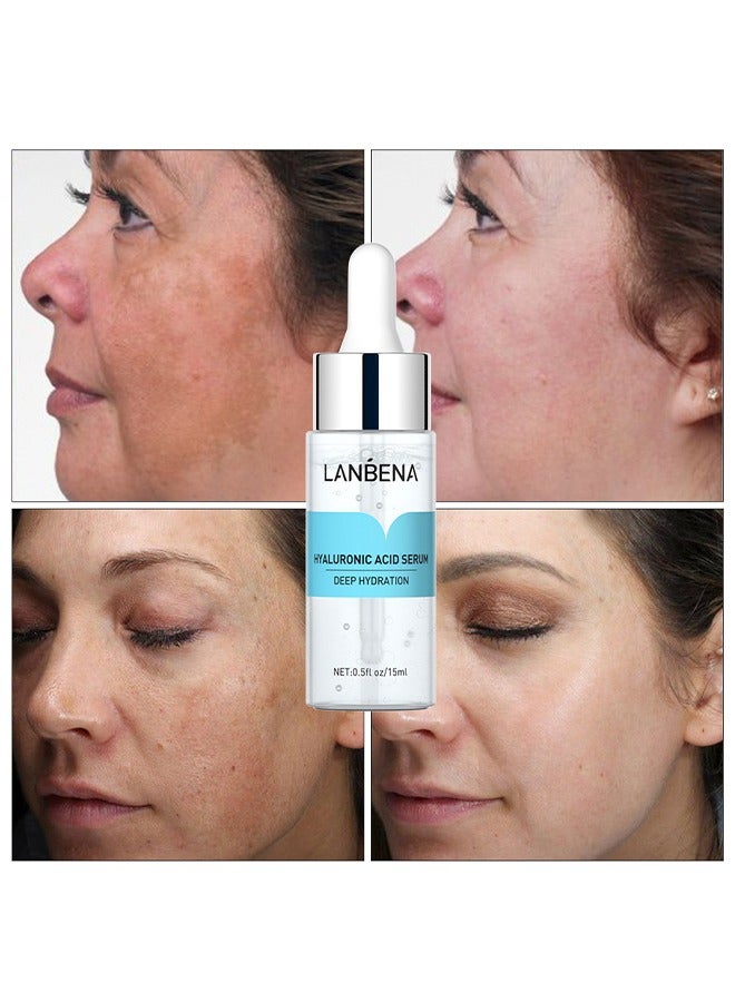 لان بينا مصل حمض الهيالورونيك ، مصل حمض الهيالورونيك النقي يخفي التجاعيد يعزز المرونة المضادة للشيخوخة 15 مل - Image 2