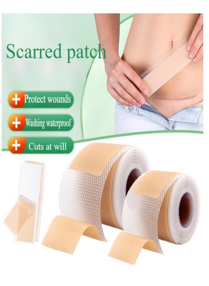 Generic Silicone Scar Tape, Medical Silicone Scar Removal Sheet, Stretch Mark Treatment Waterproof Silicone Scar Sheet, Fade Scar Effective Cosmetic Scar Removal Gel Painless Tape Roll for Cesarean Section, Burn Scars and Other Scars (4cm x 1.5m)  - Image 1